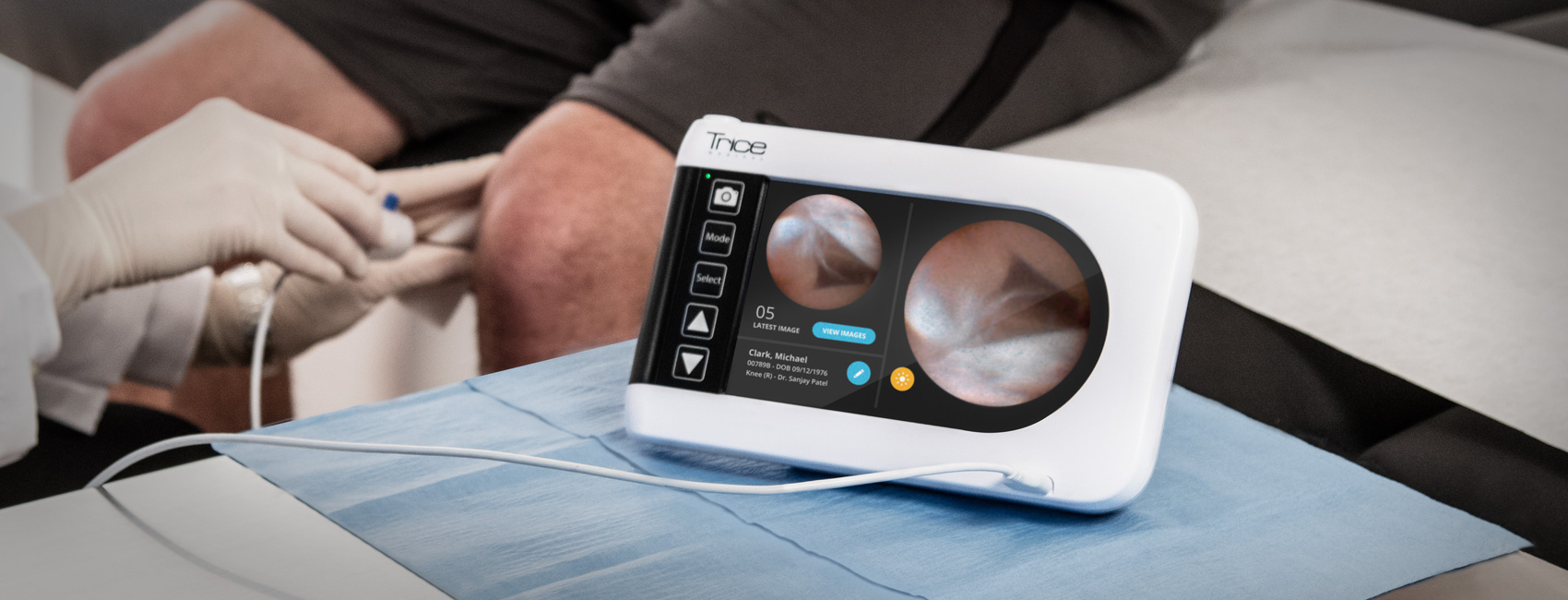 Trice Medical，Medical care equipment，Treatment of joint injury，