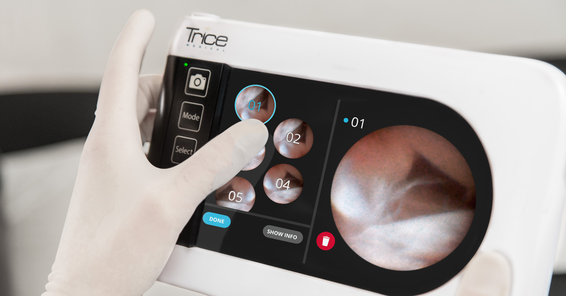 Trice Medical，Medical care equipment，Treatment of joint injury，