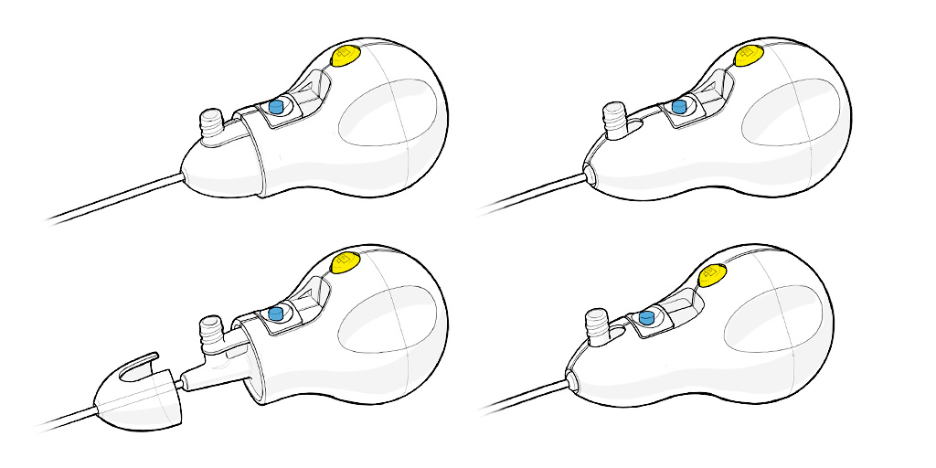 Trice Medical，Medical care equipment，Treatment of joint injury，