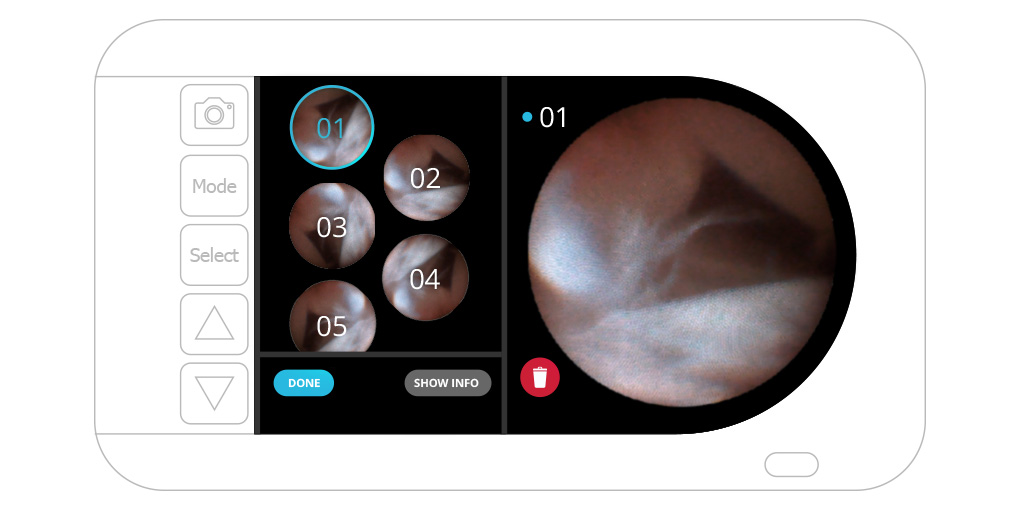Trice Medical，Medical care equipment，Treatment of joint injury，