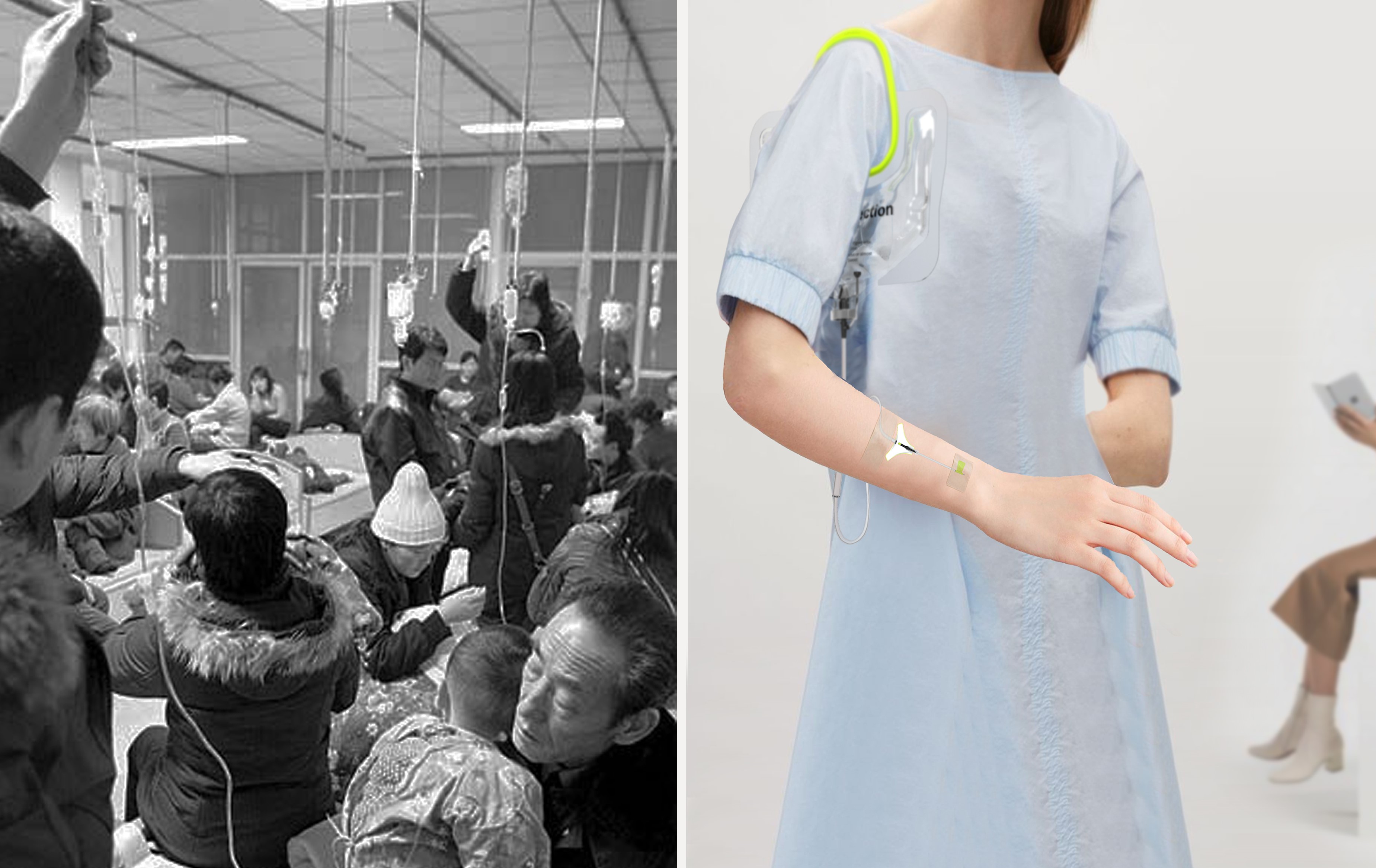 Prevent aggregation，Psychological attention，fresh，