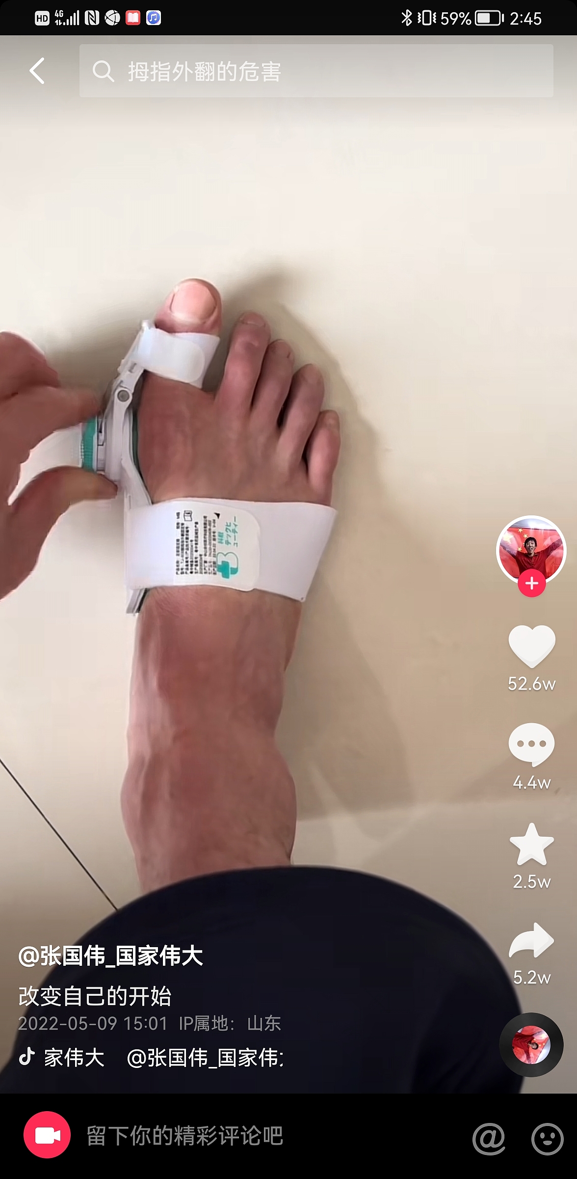 Orthotics，