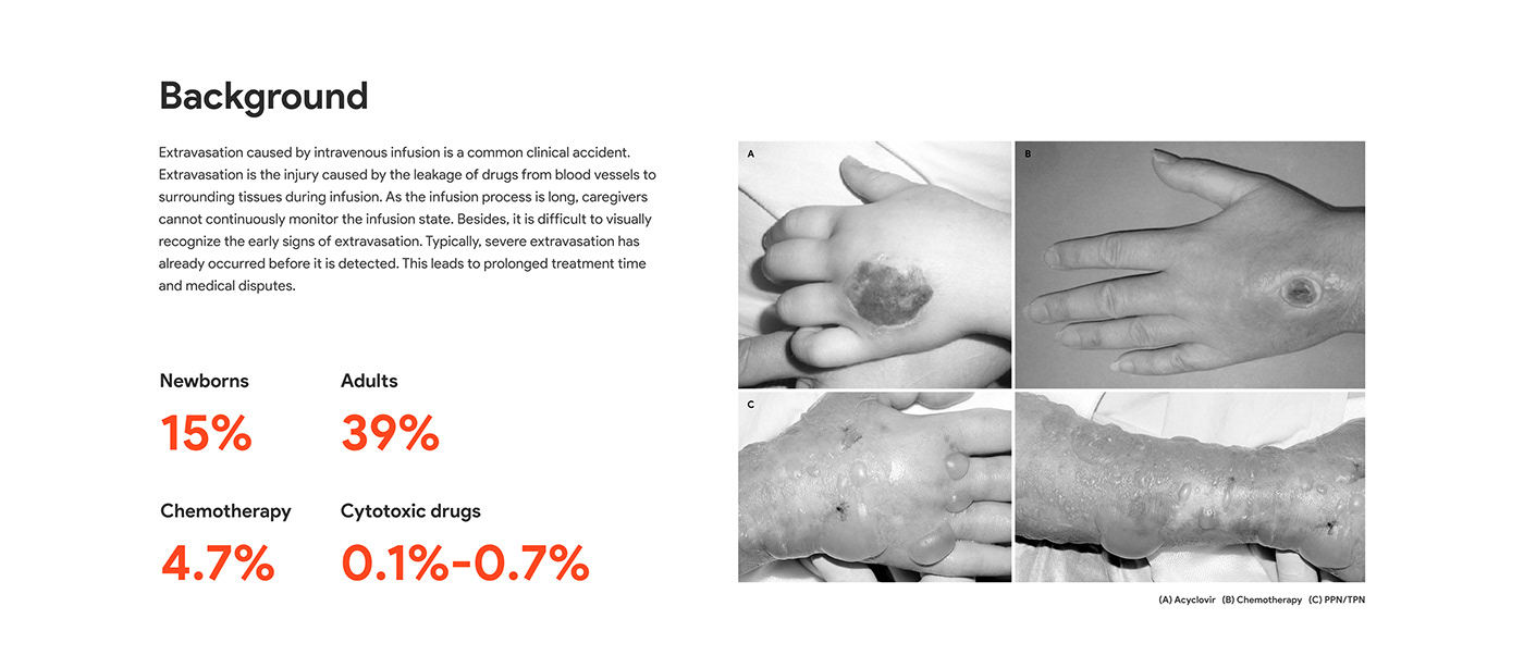 healthy，industrial design，infusion，medical care，product，product design，