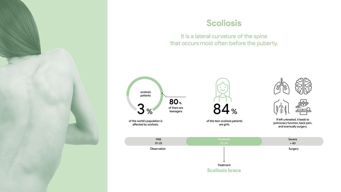 Scoliosis brace，teenagers，product design，industrial design，design，healthy，