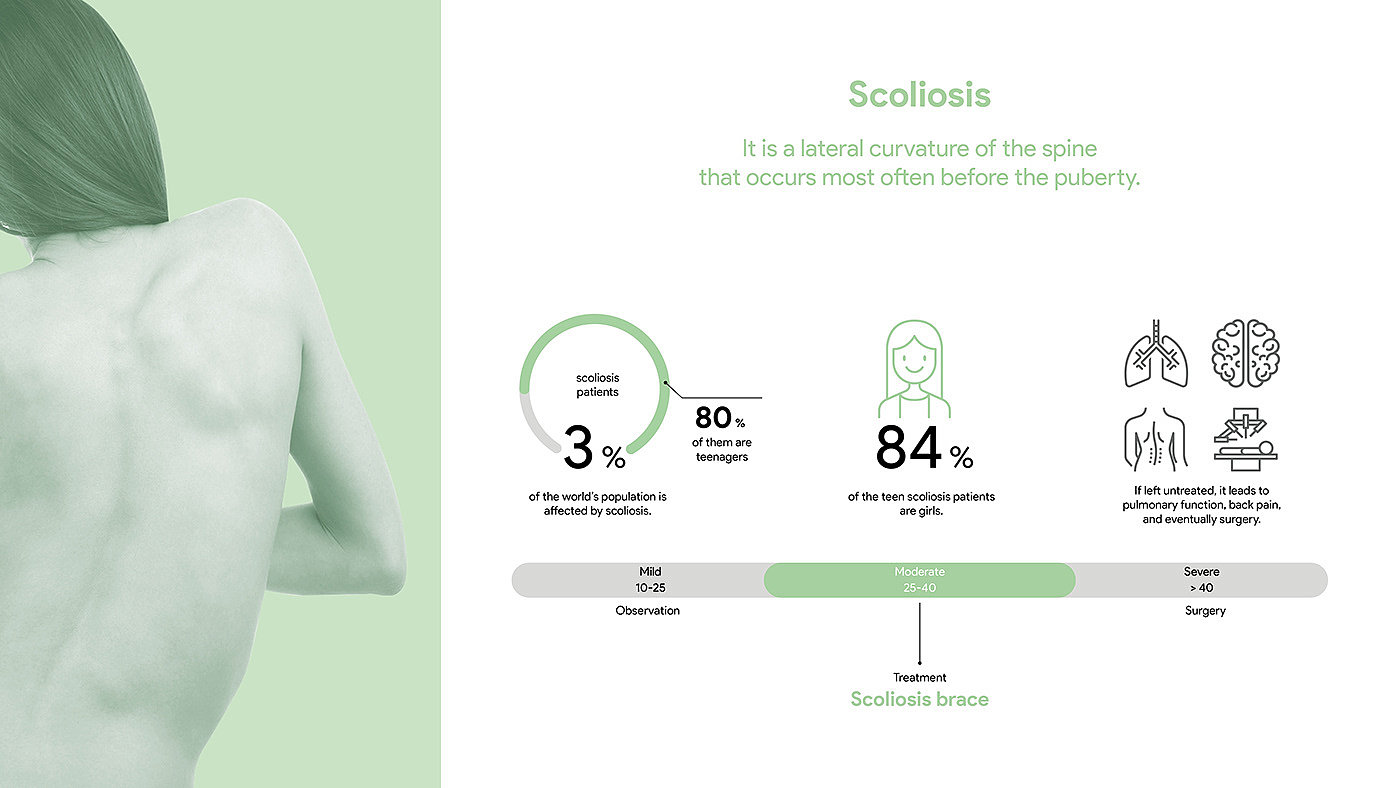 Scoliosis brace，teenagers，product design，industrial design，design，healthy，