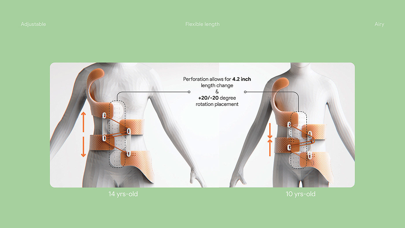 Scoliosis brace，teenagers，product design，industrial design，design，healthy，