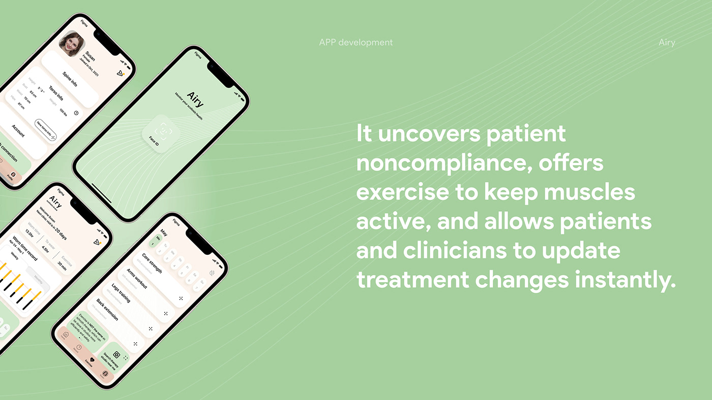 Scoliosis brace，teenagers，product design，industrial design，design，healthy，