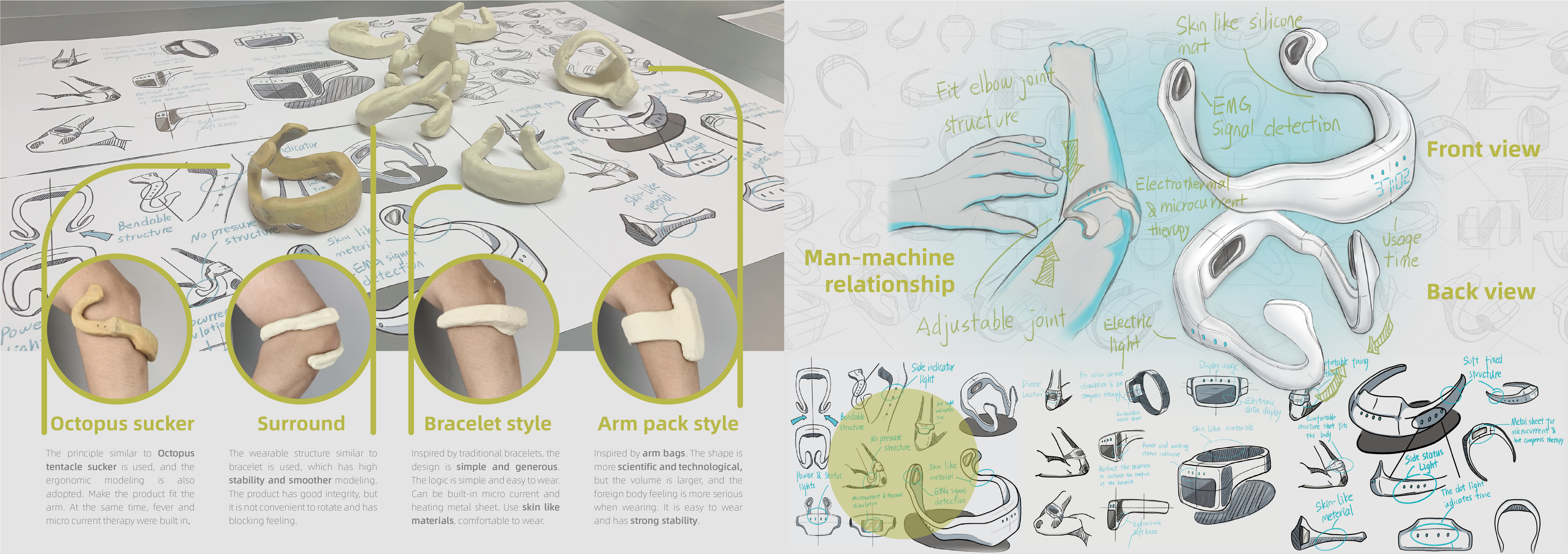 Tennis elbow，Design of Medical Aids，medical apparatus and instruments，Software material design，