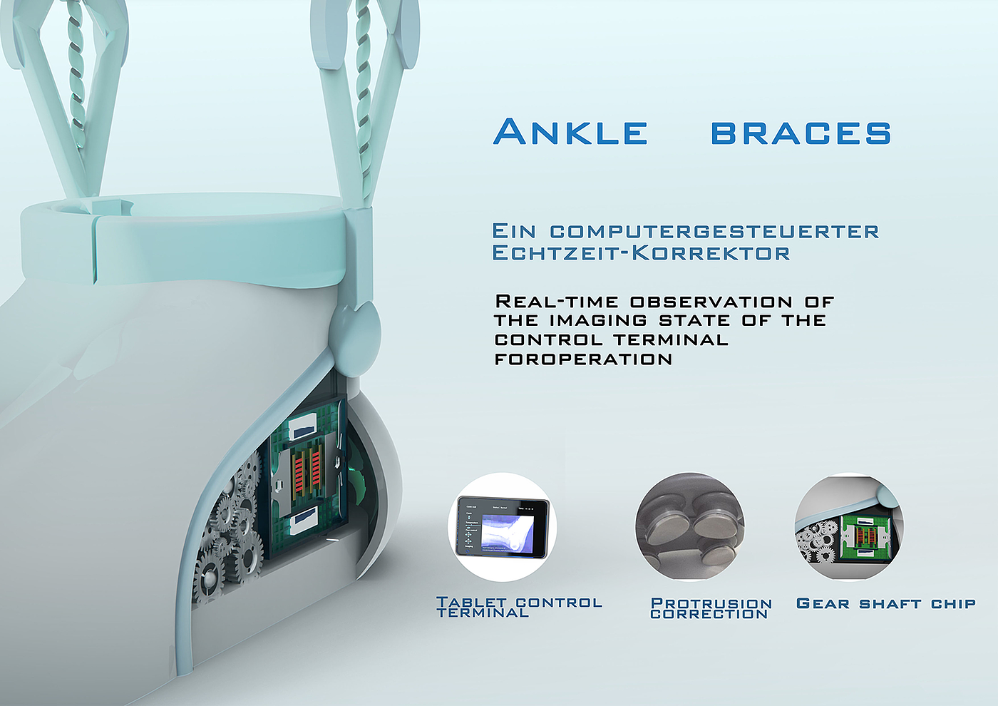 Ankle dislocation corrector，