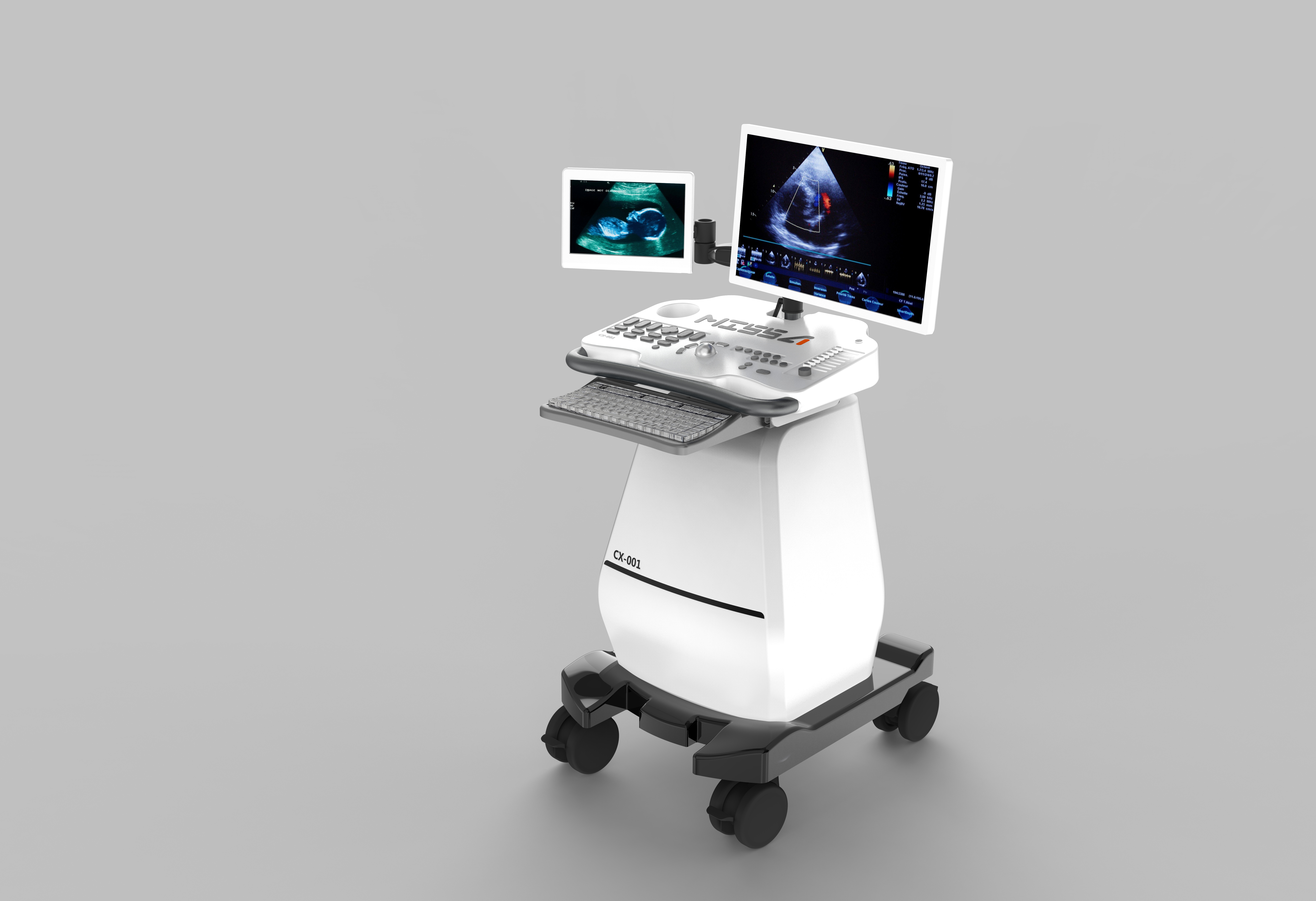Medical equipment, B- ultrasound machine，