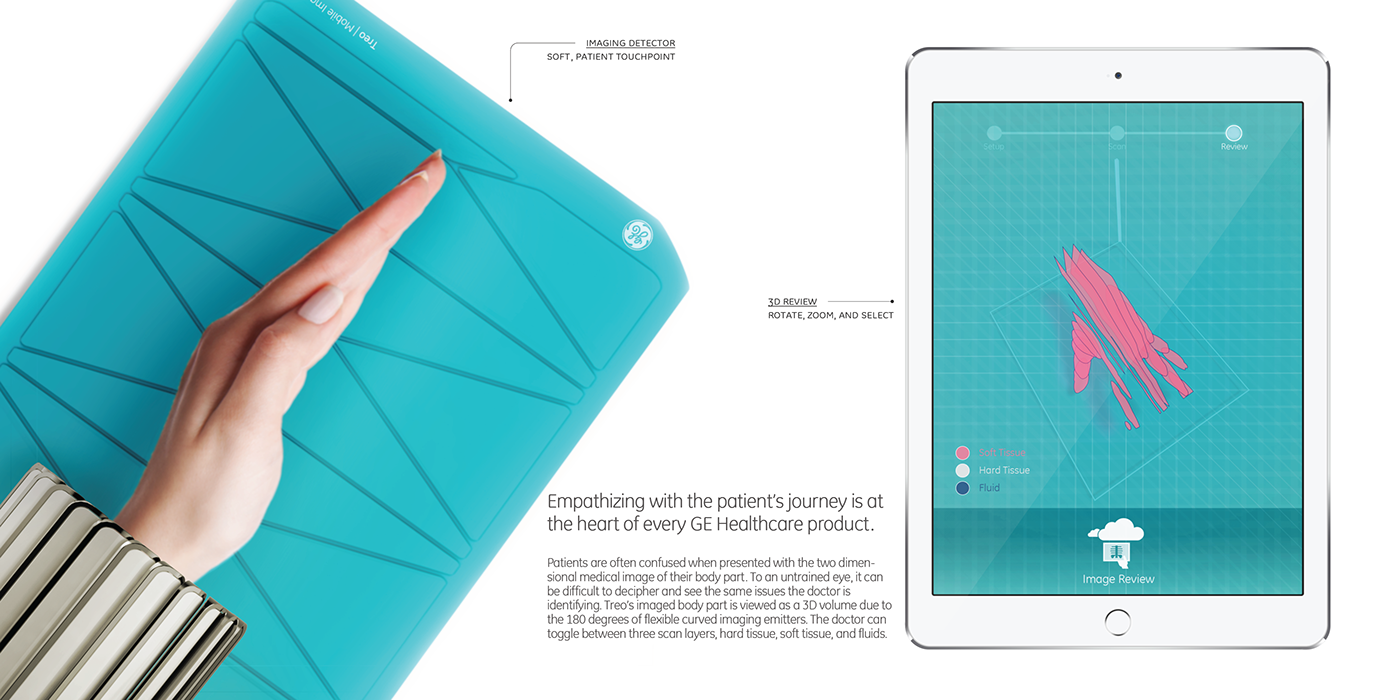 Treo，conceptual design，Medical equipment，industrial design，