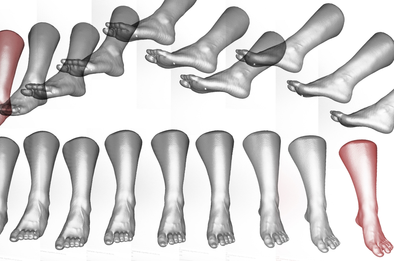 We|aver，3D printing，Elastic TPU，Hollow Knitted Structure，Treatment shoes，Ergonomic design，