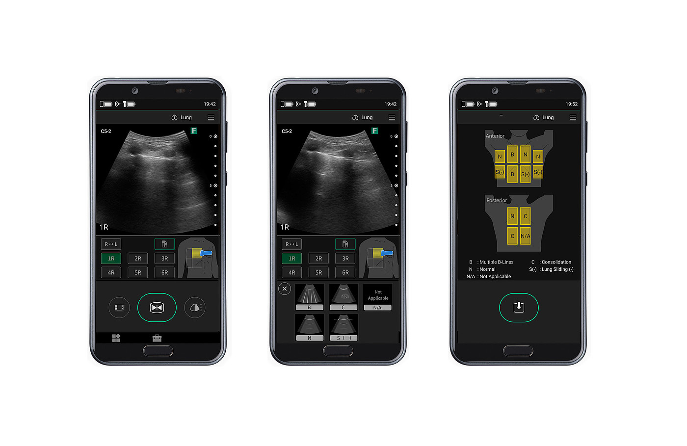 ultrasonic，Lung scan，2022 Red Dot Product Design Award，