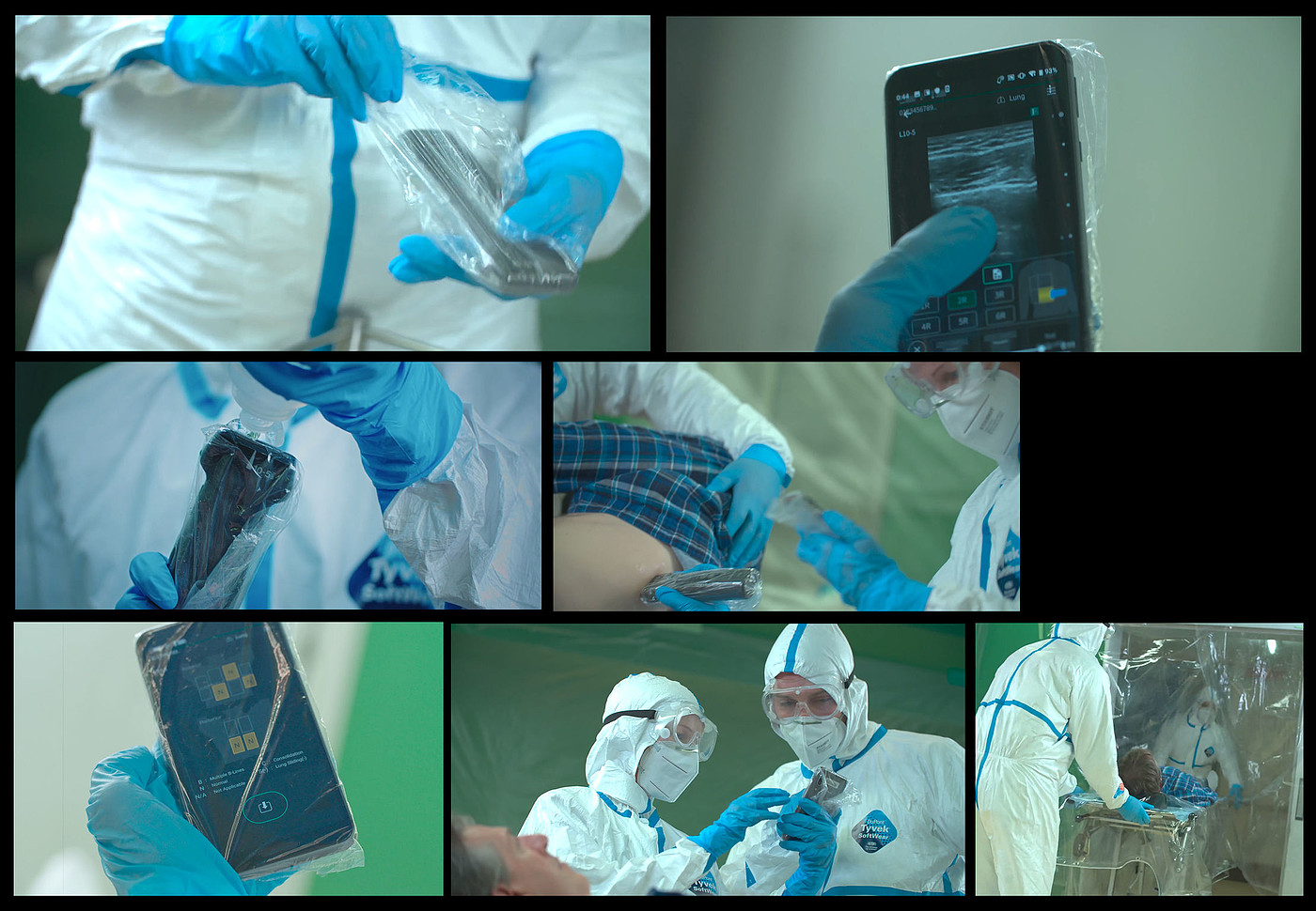 ultrasonic，Lung scan，2022 Red Dot Product Design Award，