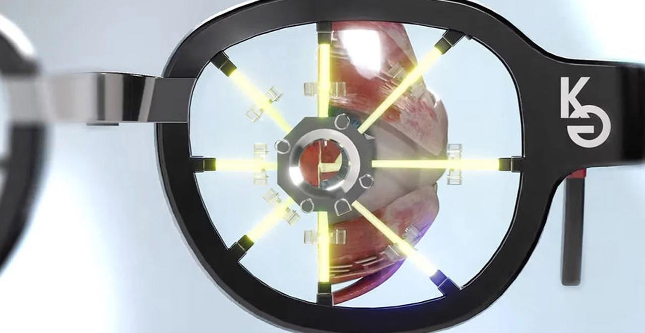 glasses，medical care，Scientific research products，Treatment of myopia，