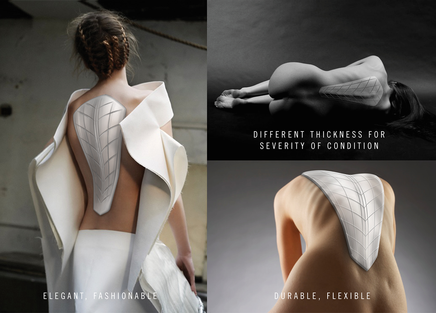 Reprint，medical care，Scoliosis posterior brace，correct，