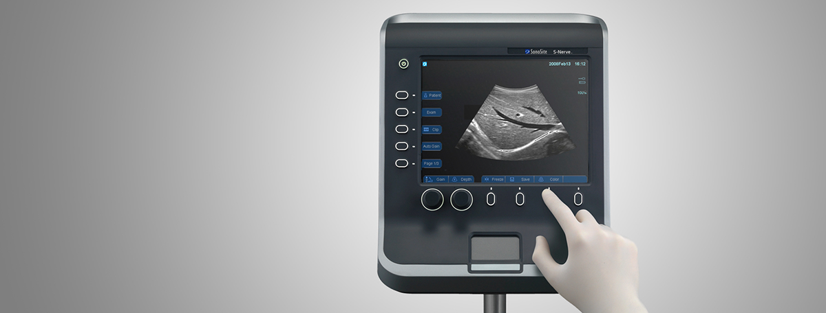 Sonosite S，medical care，Design，B-ultrasound machine，