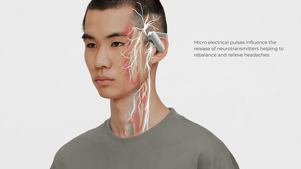 Headache，Electrotherapy，cranial nerve，