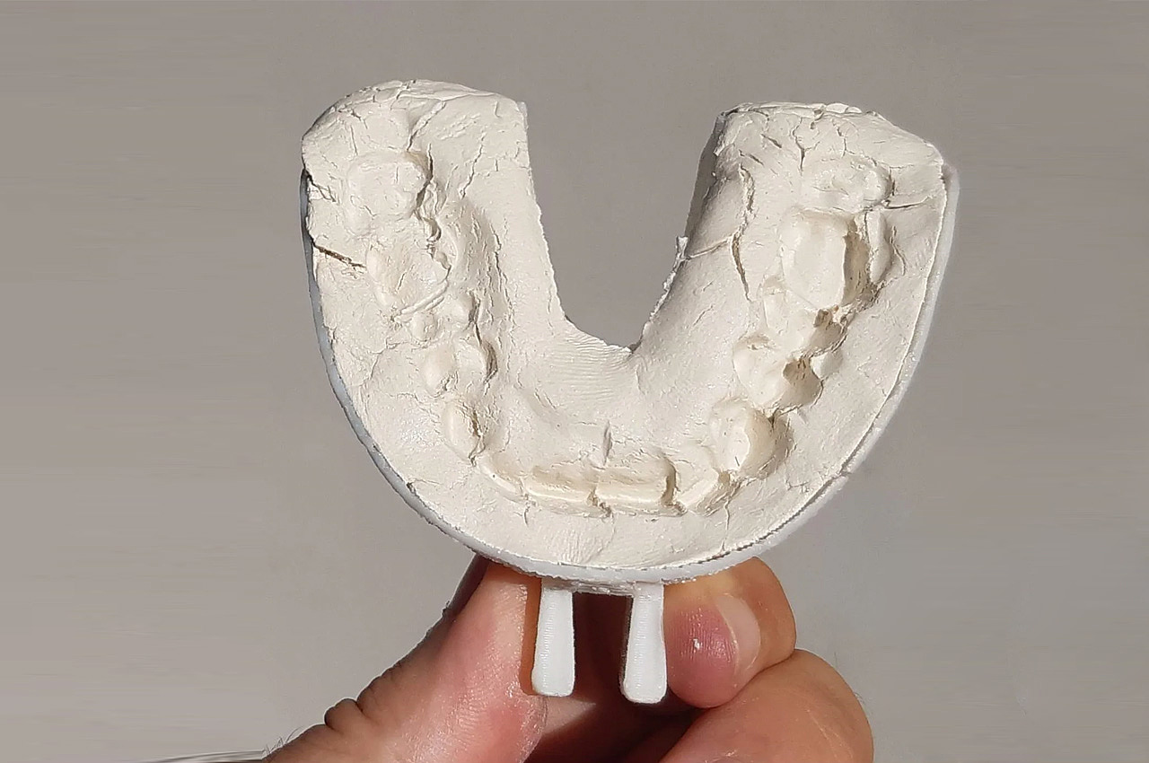 3D printing，Floss，Denture，product design，Blizzard，