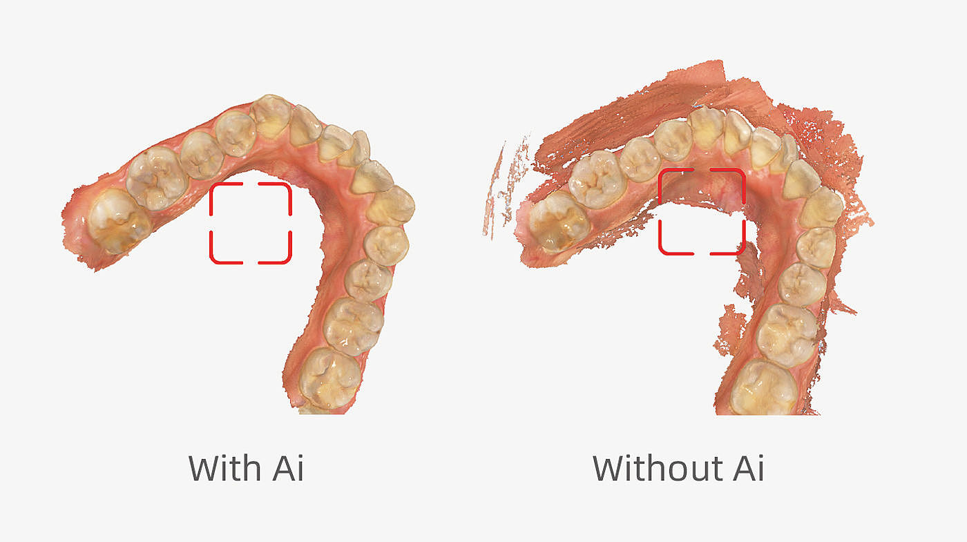 product design，Medicine/Health，Clinical intraoral scanner，