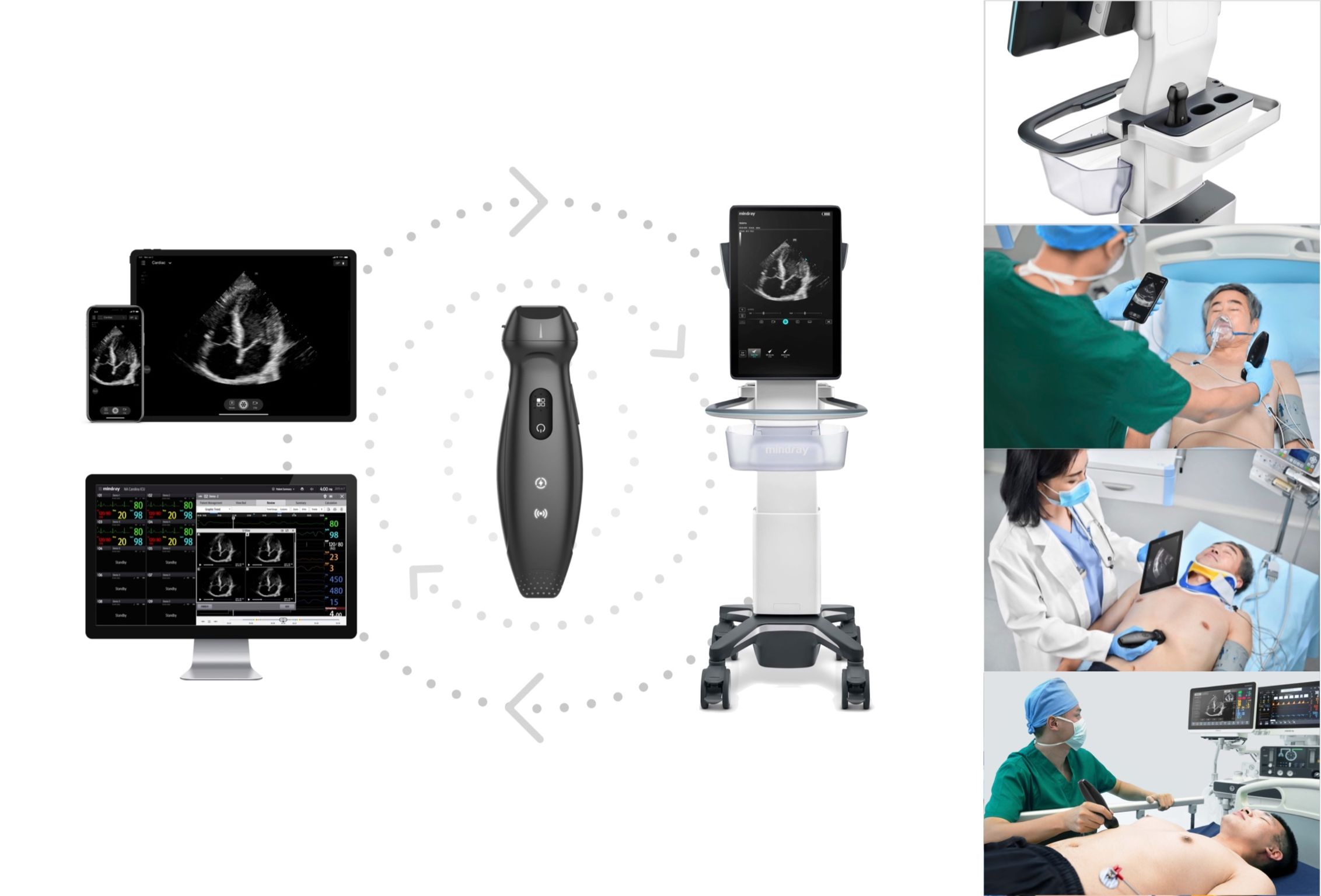 User experience (UX)，Product design UX，POC ultrasound，