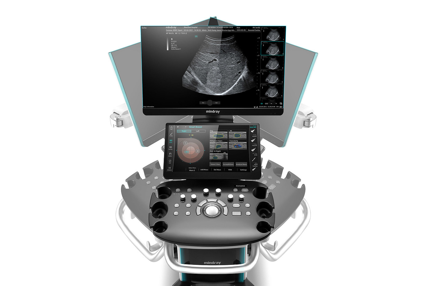 product design，Medicine/Health，Ultrasonic diagnosis system，