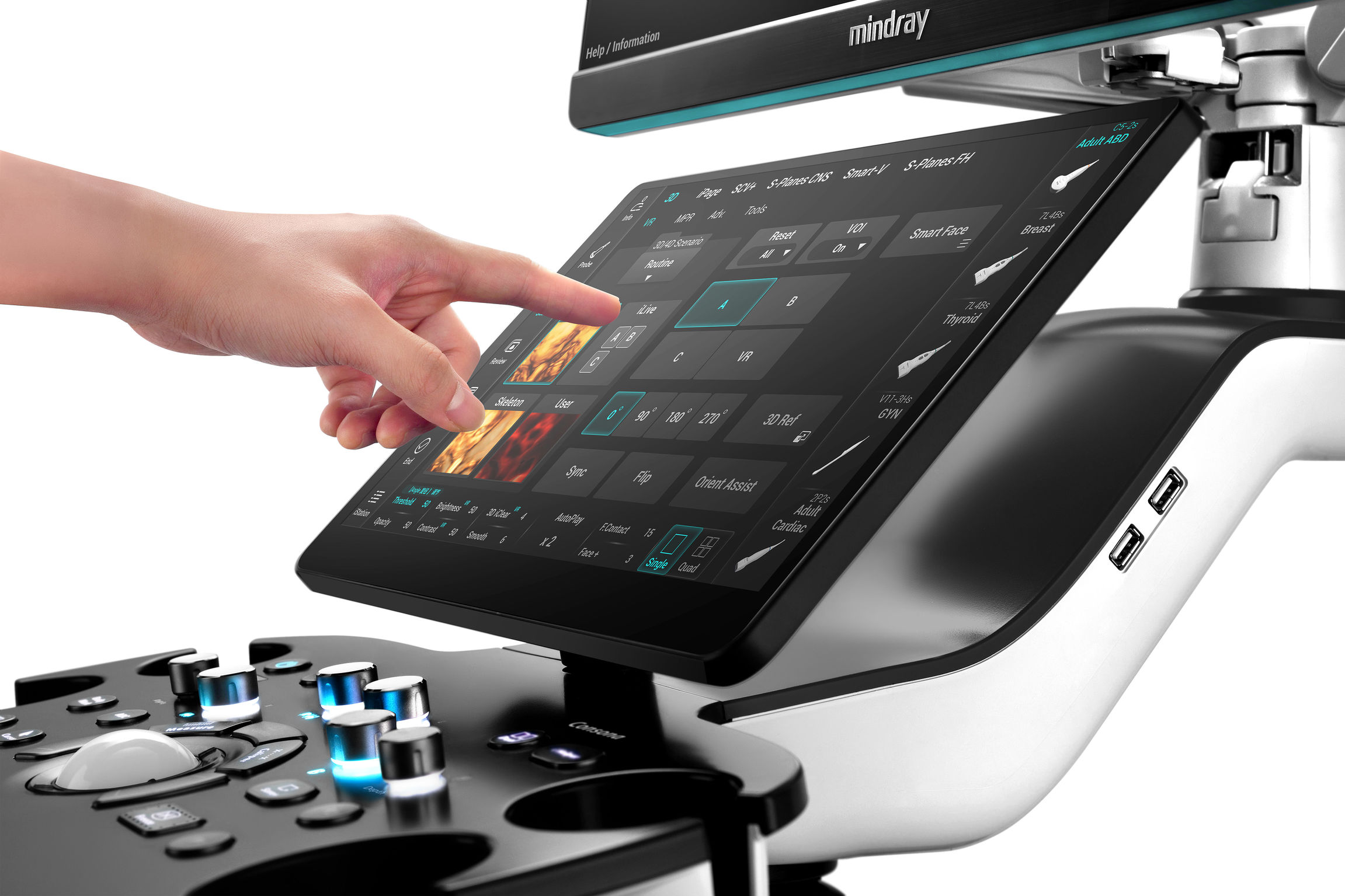 product design，Medicine/Health，Ultrasonic diagnosis system，