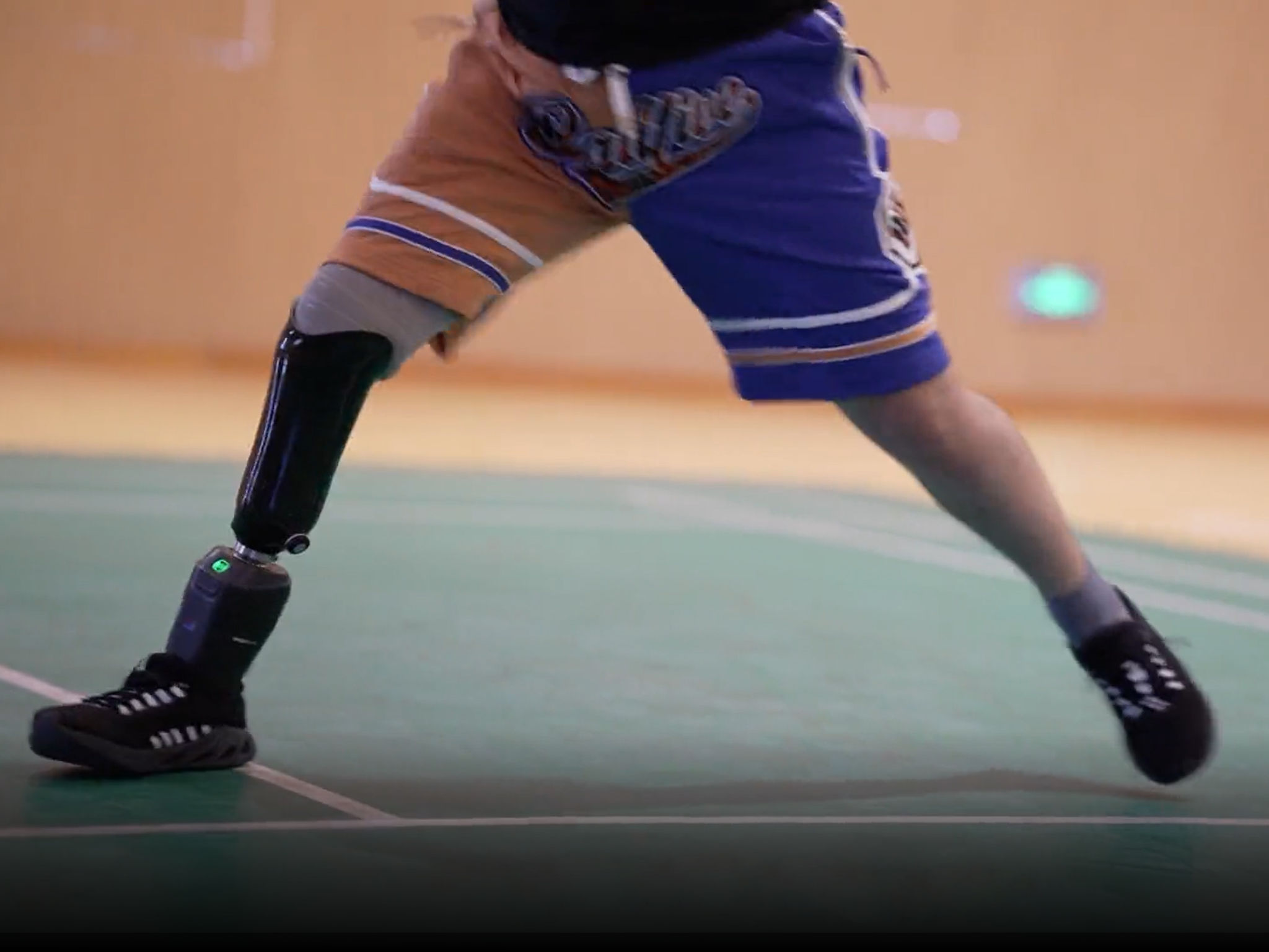 product design，Medicine/Health，prosthesis ，