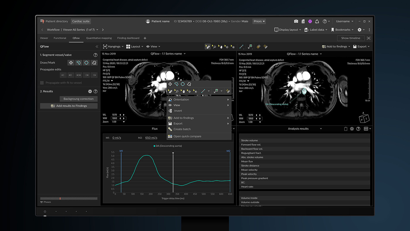 User interface (UI)，Product interface，Medical imaging equipment，