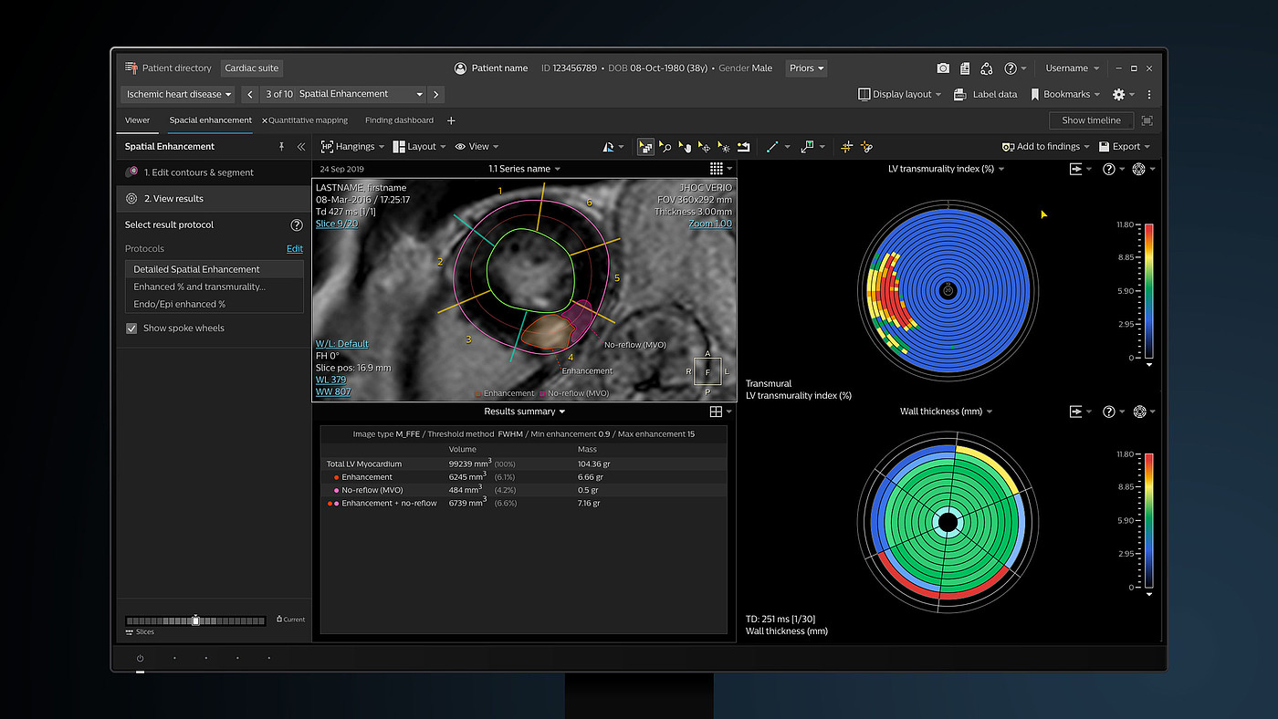 User interface (UI)，Product interface，Medical imaging equipment，