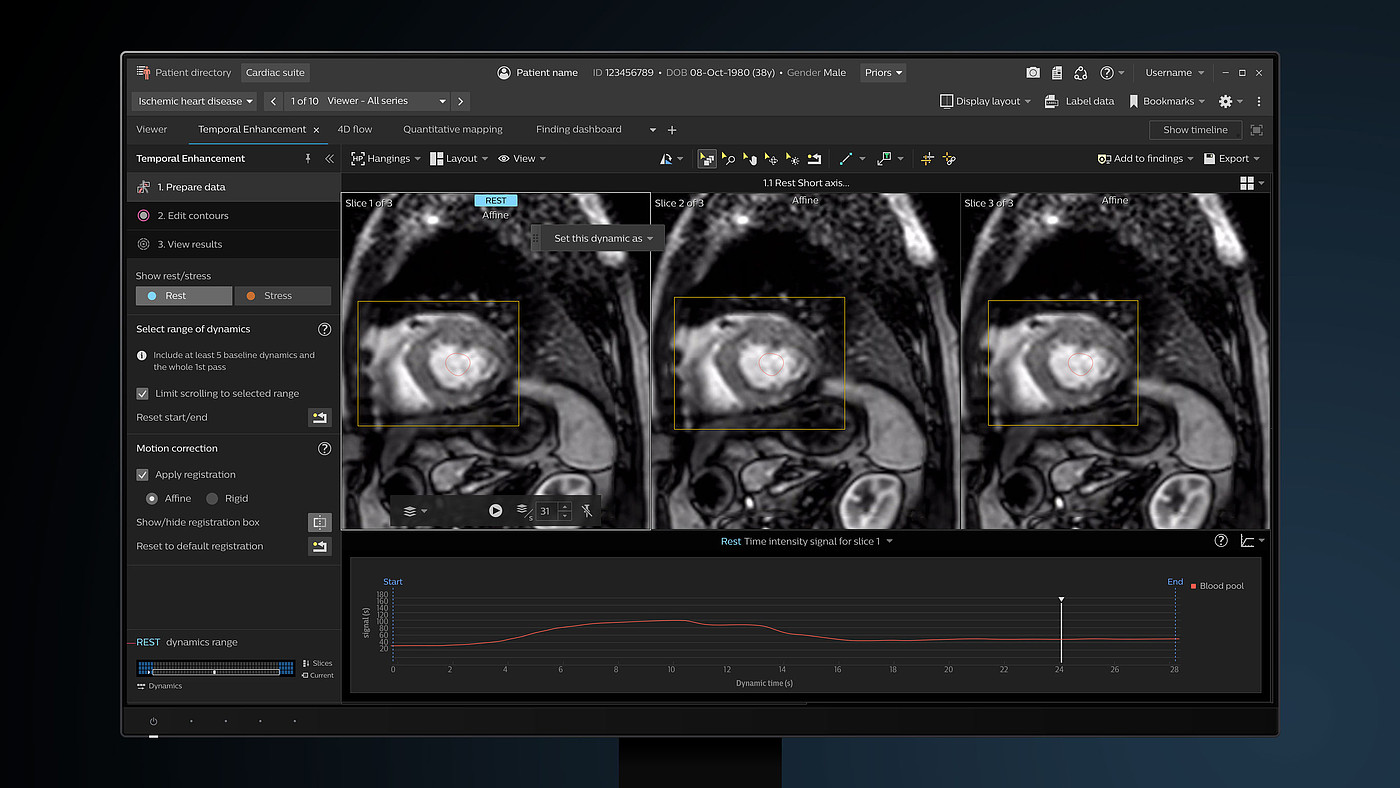 User interface (UI)，Product interface，Medical imaging equipment，