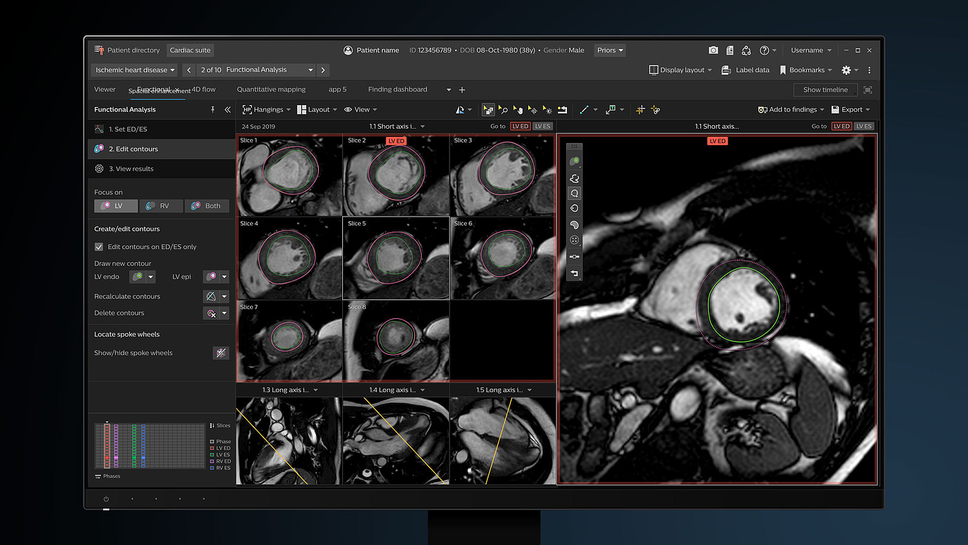 User interface (UI)，Product interface，Medical imaging equipment，