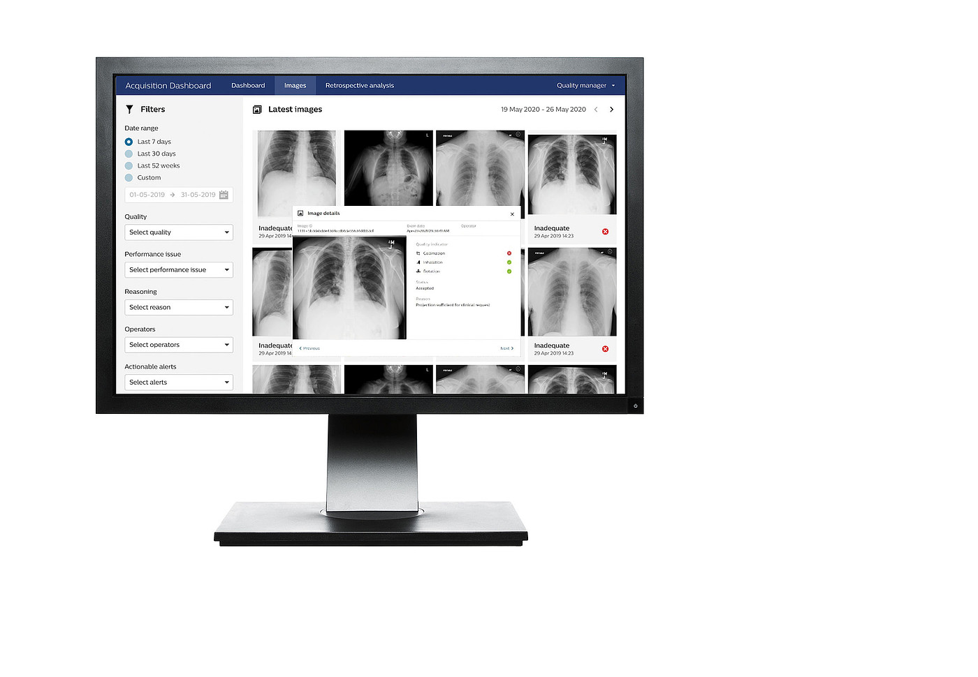 User interface (UI)，Digital media interface，Medical QA imaging tool，