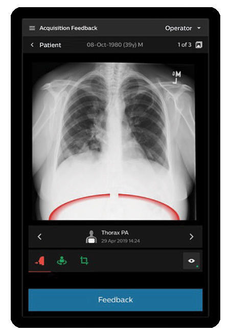User interface (UI)，Digital media interface，Medical QA imaging tool，