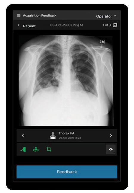 User interface (UI)，Digital media interface，Medical QA imaging tool，