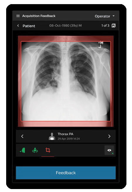 User interface (UI)，Digital media interface，Medical QA imaging tool，