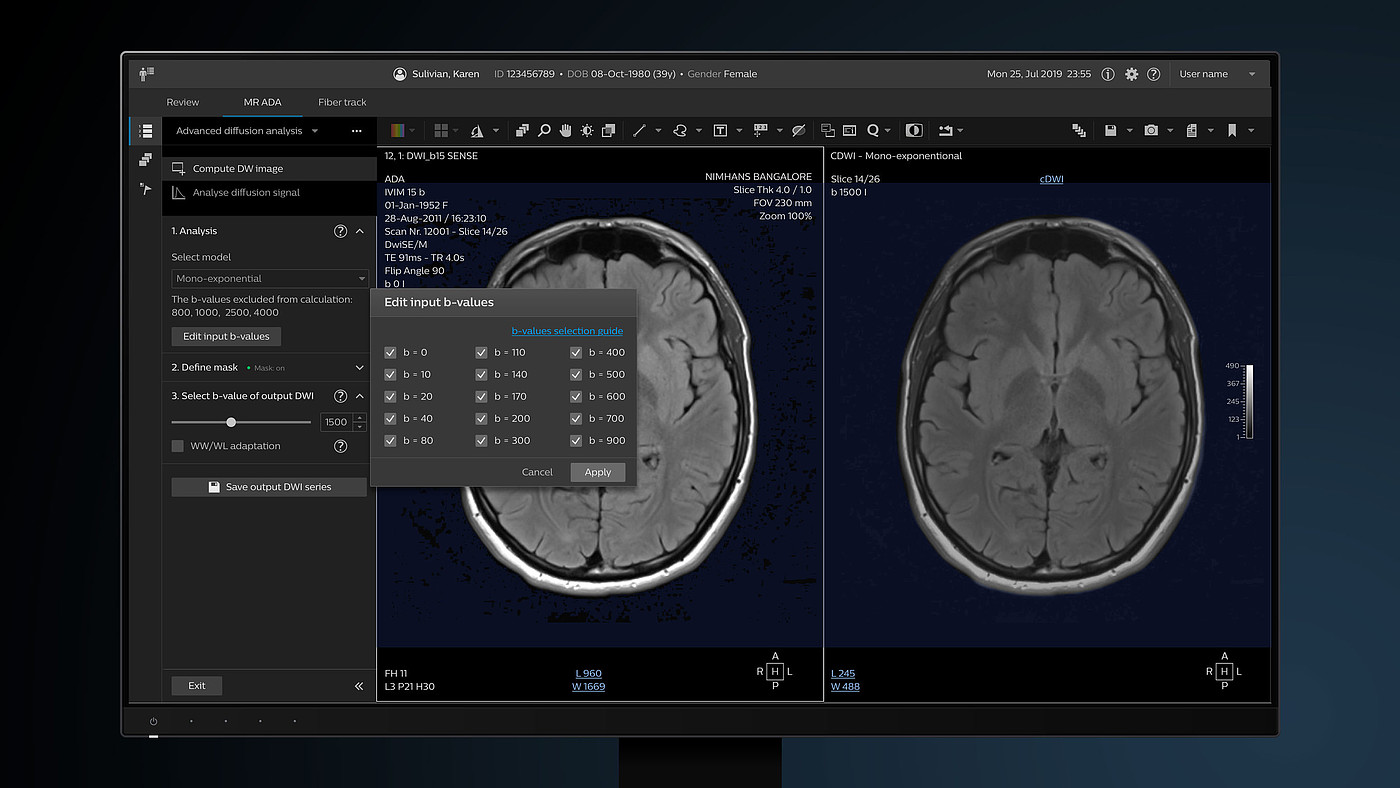User interface (UI)，Digital media interface，Magnetic resonance diagnostic applications，