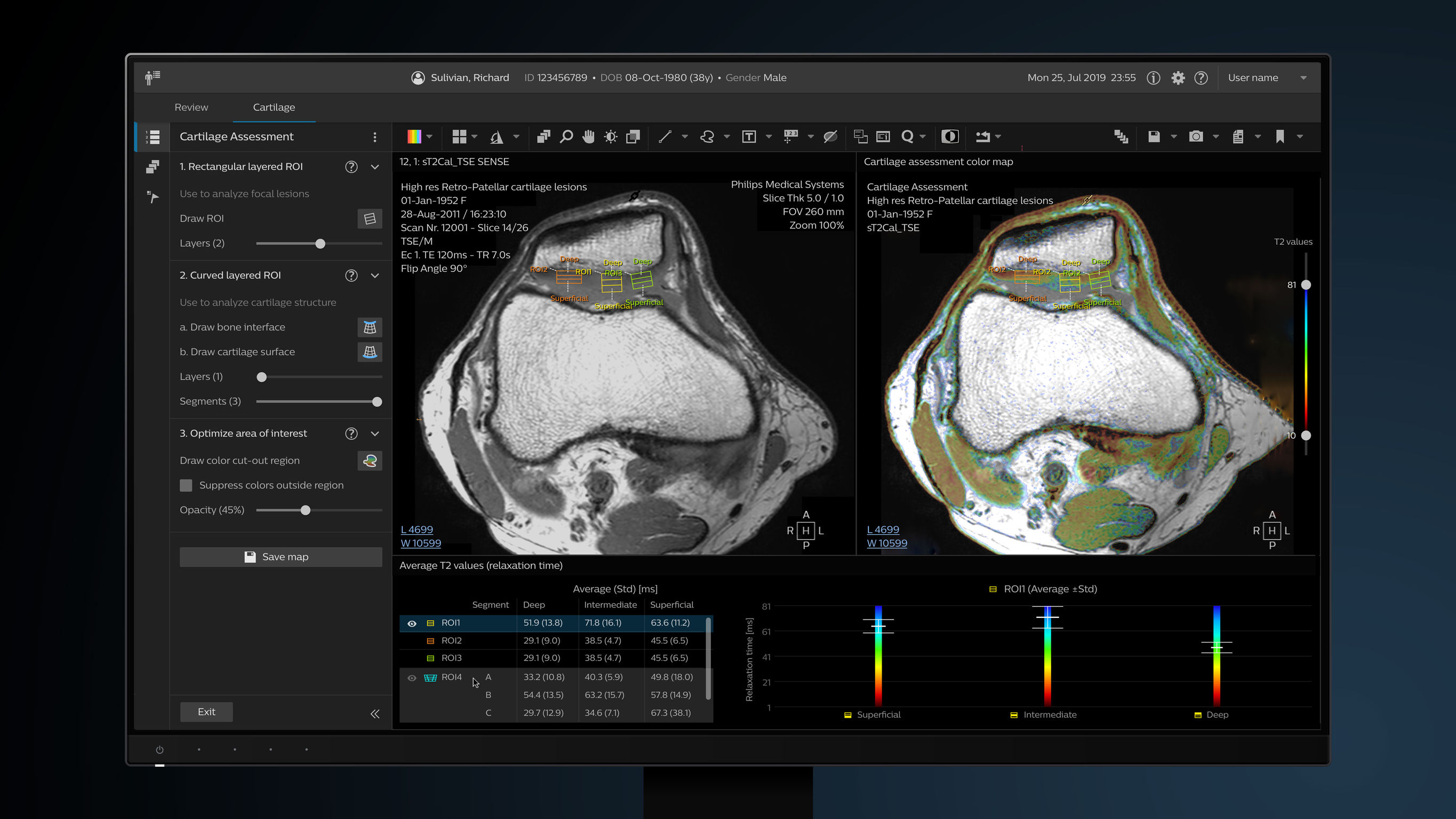 User interface (UI)，Digital media interface，Magnetic resonance diagnostic applications，