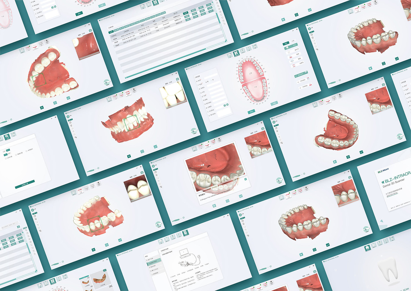 用户体验(UX)，产品设计 UX，口内扫描仪，