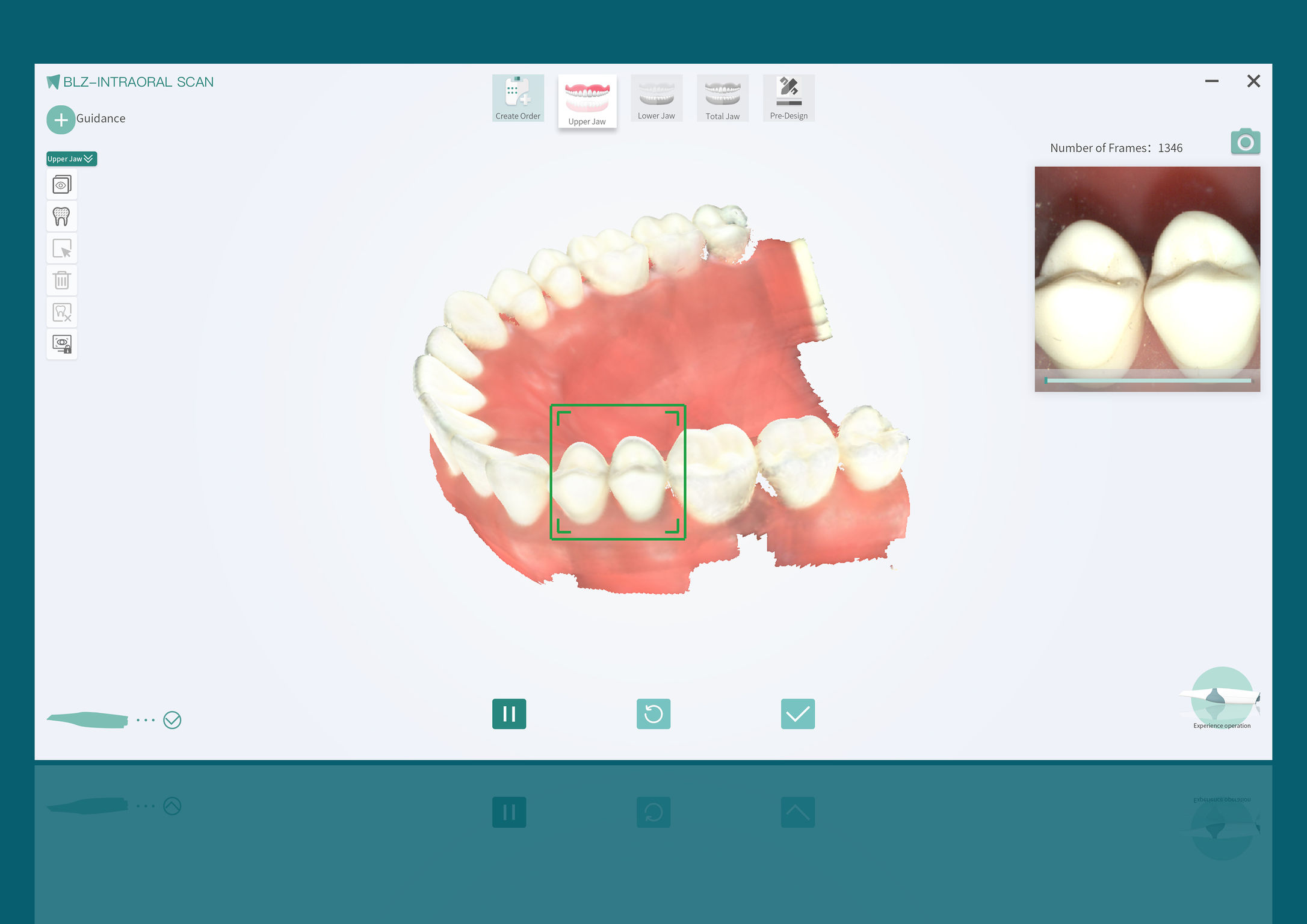 User experience (UX)，Product design UX，Intraoral scanner，