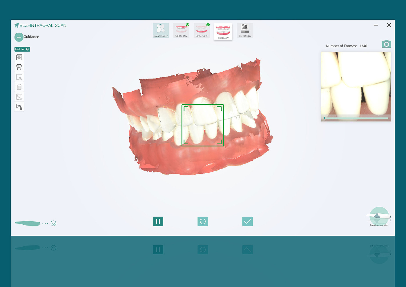 User experience (UX)，Product design UX，Intraoral scanner，