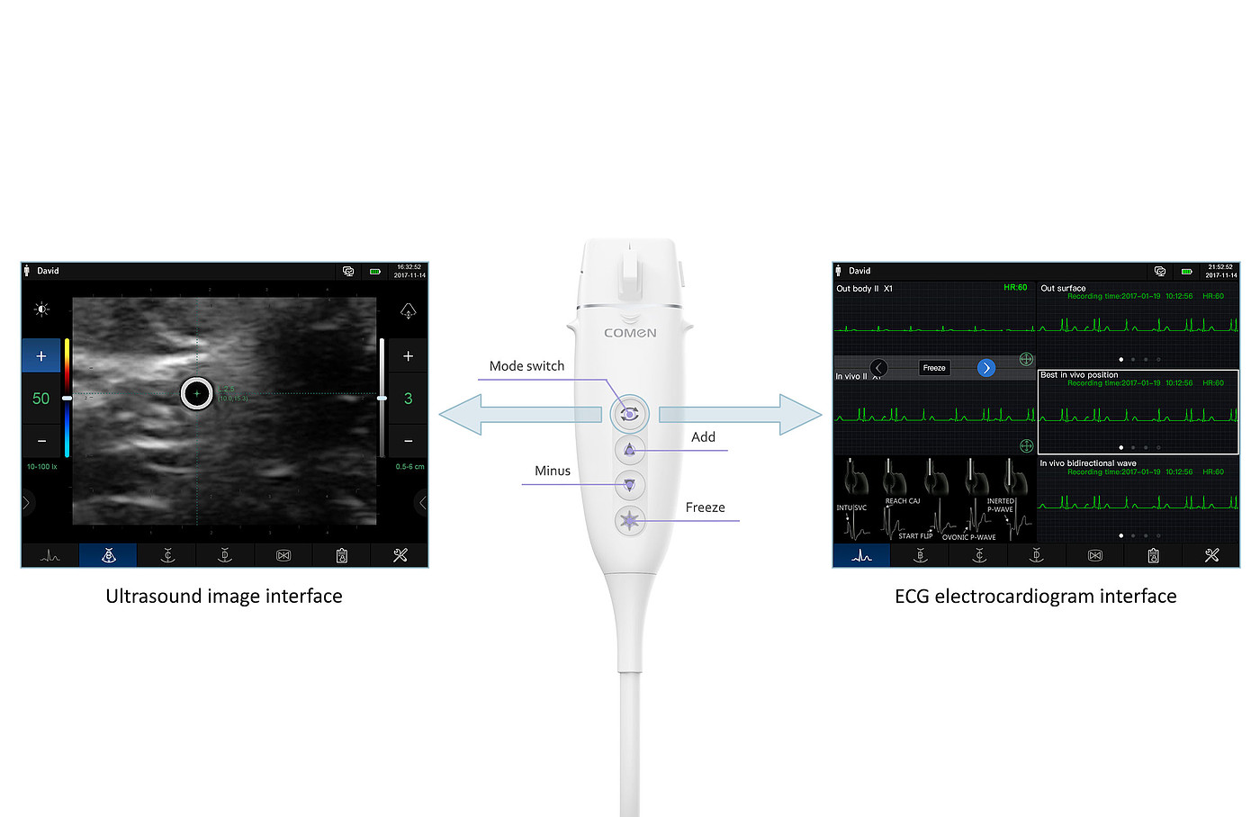 product design，Medicine/Health，Catheter system，