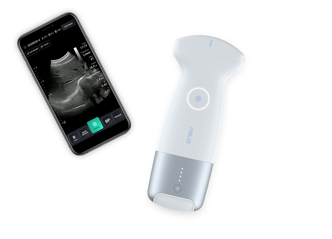 product design，Medicine/Health，Ultrasonic imaging system，