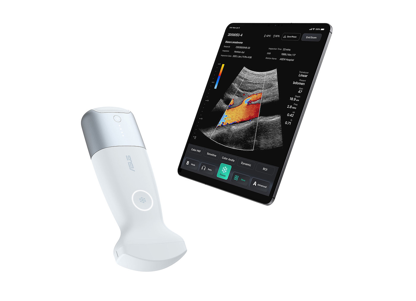 product design，Medicine/Health，Ultrasonic imaging system，