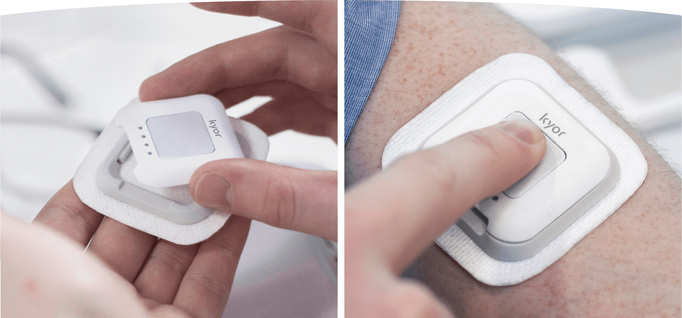 Kyor，Manual treatment，industrial design，Physiotherapy，Medical Science，