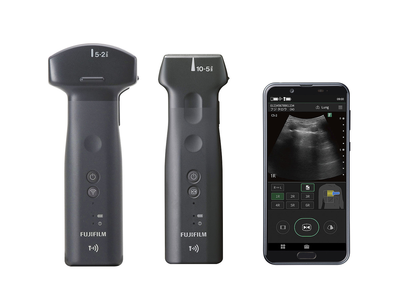 product design，Medicine/Health，Ultrasonic imaging equipment，