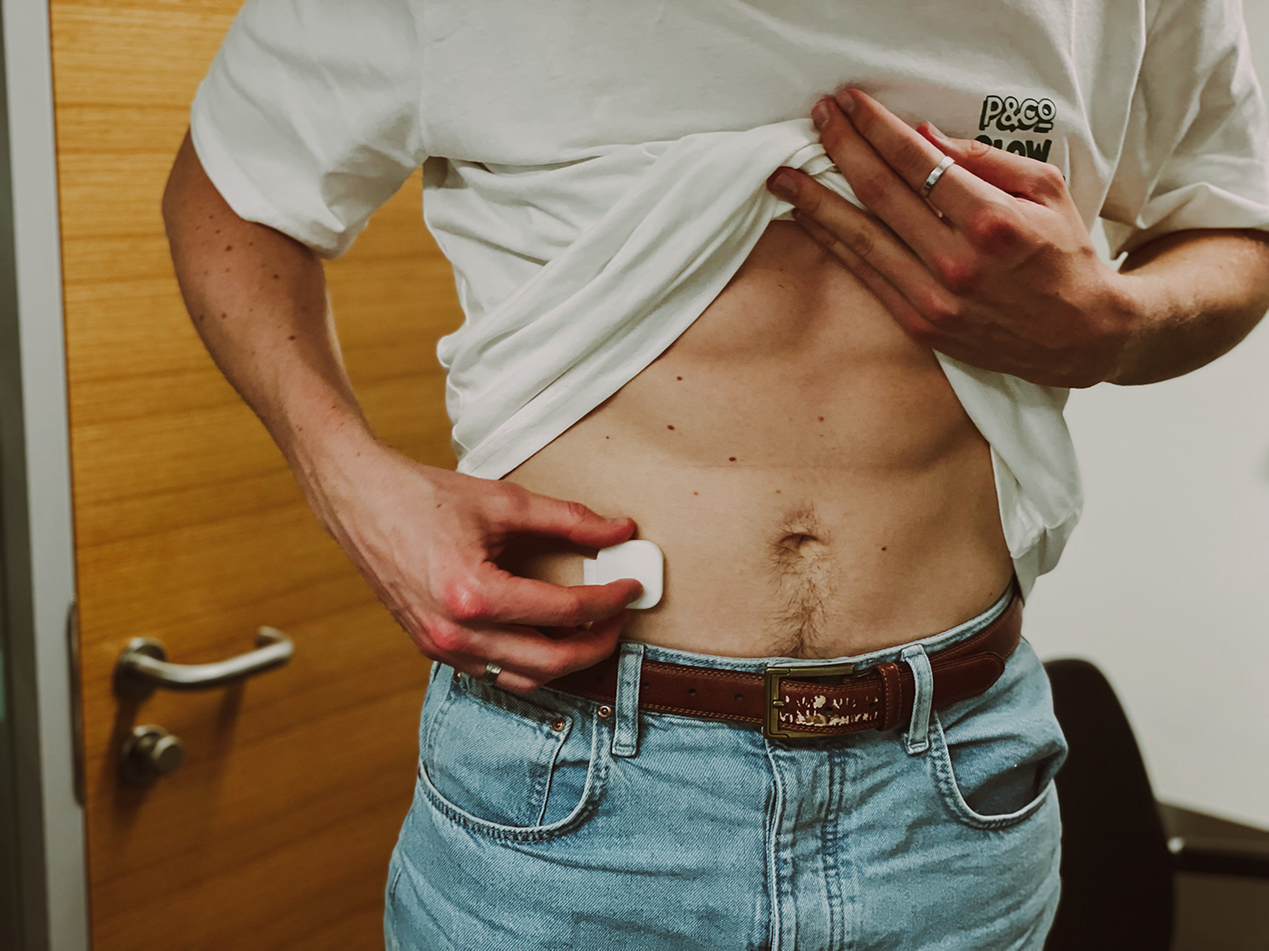 product design，Prosmate，medical care，Prostate cancer，