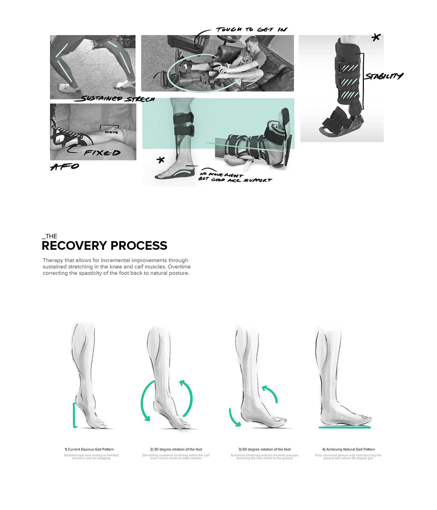 medical care，Science and Technology，product design，bionics，Prosthesis，