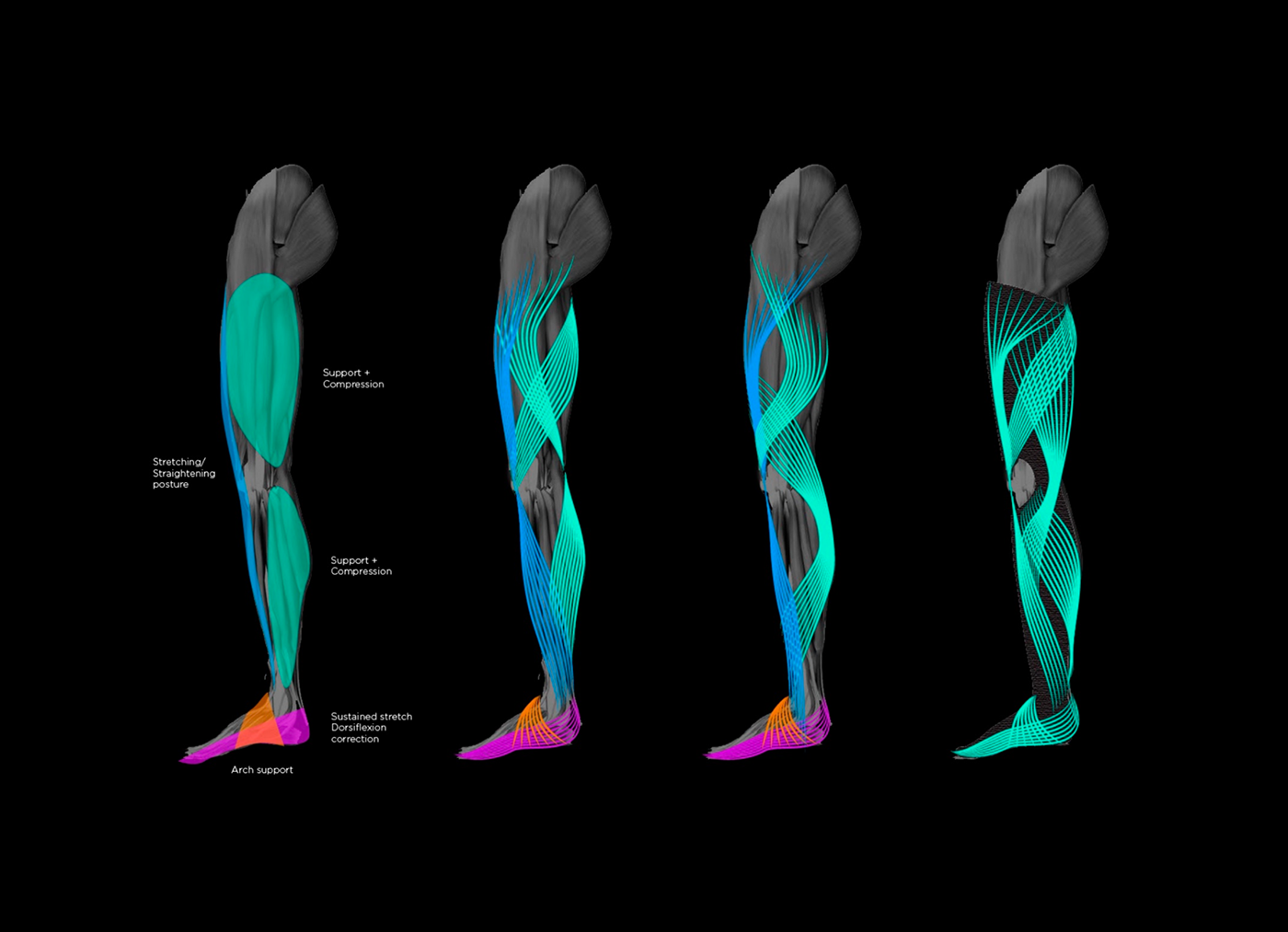 medical care，Science and Technology，product design，bionics，Prosthesis，