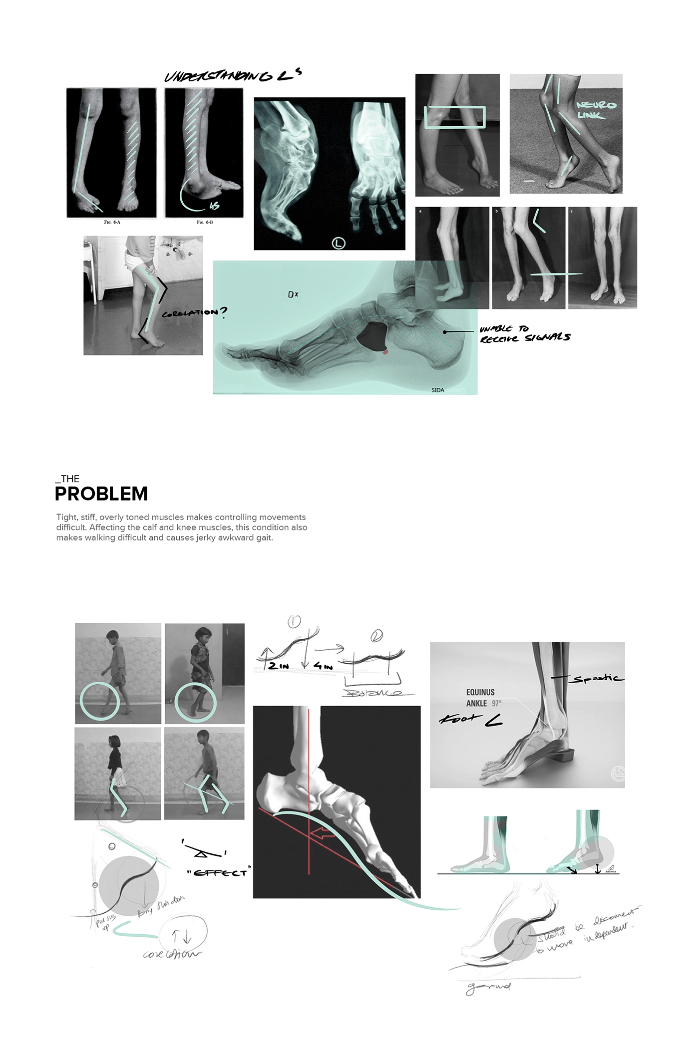 medical care，Science and Technology，product design，bionics，Prosthesis，